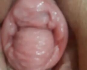 Loose pumped pussy prolapse pushing out